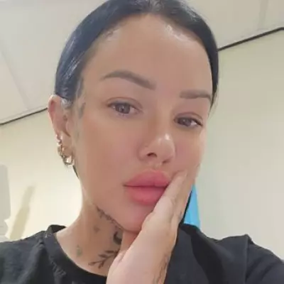 Mum Dismissed as 'Just Busy' Paid for Private Scans to Discover Thyroid Cancer