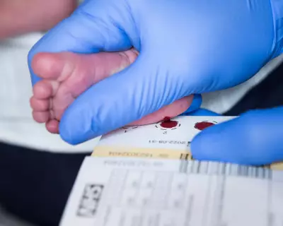 Scotland Pioneers UK Newborn Screening for Spinal Muscular Atrophy