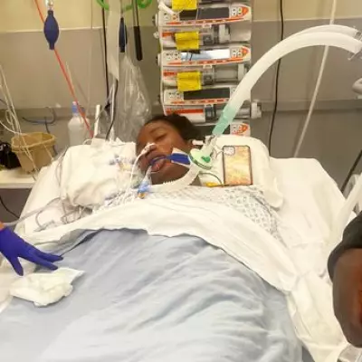 Student's Meningitis Nightmare: Legs and Fingers Lost After Fresher's Flu Misdiagnosis