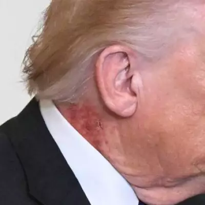 Trump's Health Riddles: From Neck Scabs to Hidden Bruises and Lumps