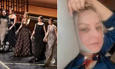 Wendi McLendon-Covey Misses Bridesmaids Oscar Reunion After Neck Lift Surgery