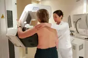 AI Detects Heart Disease Risk During Routine Breast Cancer Screenings
