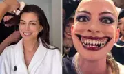 Anne Hathaway Jokes About Oscars Skin Comments with Witch Transformation