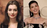 Anne Hathaway's Ageless Oscars Look Sparks Cosmetic Expert Analysis