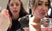 Beauty Expert Warns of Dangers in At-Home Devices After Personal Mishap
