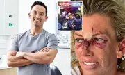 Boxing Training Saves Photographer from Celebrity Dentist's Violent Attack