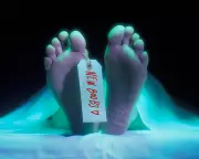 Cadaver Fat Injections: The Rise of 'Zombie Filler' Alloclae in Cosmetic Surgery