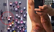 Cycling Star Michal Kwiatkowski Reveals Graphic Crash Injuries on Instagram