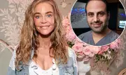 Denise Richards' Plastic Surgeon Details Her Complete Facelift Transformation