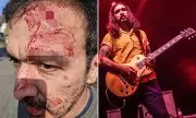 Former Zutons Guitarist Survives Racist Attack in Liverpool