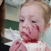 Four-Year-Old Girl's Life Changed Forever After Vicious Bulldog Attack