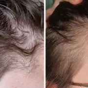 Hair 'Growing Like Crazy' with 56p-a-Day Supplement: 'My Hairdresser Noticed'