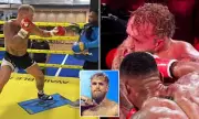 Jake Paul Teases Boxing Comeback Announcement After Second Jaw Surgery