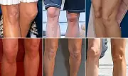 Knees Reveal True Age: Why Your Face May Not Be the First to Show Signs