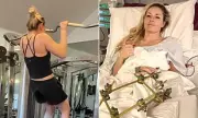 Lindsey Vonn Defies Odds with Gym Return After Near-Leg Amputation