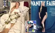 Lindsey Vonn Recounts Near-Leg Amputation After Olympic Crash Horror