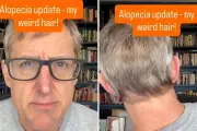 Louis Theroux Reveals Alopecia Battle Peaked During Manosphere Documentary