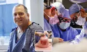 Man Receives Human Kidney After Historic Pig Organ Transplant Fails