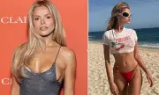Model Brooks Nader's Liposuction Regret and Candid Plastic Surgery Confessions