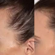 Mum's £35 Serum Boosts Post-Baby Hair Growth, Now on Mother's Day Sale