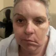 Mum's Holiday Fall Led to Coma but Revealed Life-Saving Brain Tumour