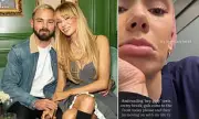 Olivia Attwood's Emotional Instagram Post Hints at Bradley Dack's Infidelity