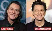 Plastic Surgeons Speculate on Jim Carrey's Dramatic New Look After Paris Awards
