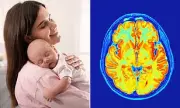 Pregnancy Triggers Brain 'Rewiring' for Parenthood, Not Just 'Baby Brain'