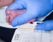 Scotland Pioneers UK Newborn Screening for Spinal Muscular Atrophy