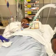 Student's Meningitis Nightmare: Legs and Fingers Lost After Fresher's Flu Misdiagnosis