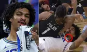 UCLA's Skyy Clark Loses Tooth in Gruesome March Madness Injury