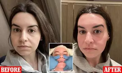 Buccal Facial Massage: The $400 'Non-Surgical Facelift' Celebrities Swear By