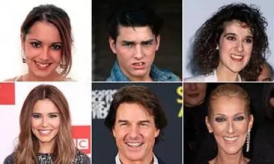 Celebrity Smile Transformations: From Crooked Teeth to Hollywood Grins