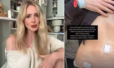 Diana Vickers Diagnosed with Pelvic Congestion Syndrome After Years of Pain