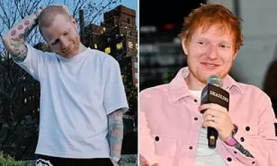 Ed Sheeran Shaves Head for Fresh Start, Reveals Shingles Battle