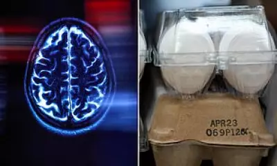 Eggs Twice a Week Slash Alzheimer's Risk by 20%, New Study Finds