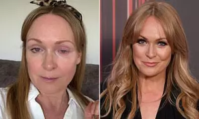 Emmerdale Star Michelle Hardwick Hospitalised with Eye Injury, Shares Recovery Journey