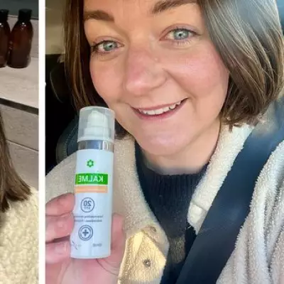 Kalme's Rosacea Solutions Earn Rave Reviews for Redness Relief and Coverage