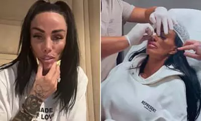 Katie Price Admits Botox Left Her Face 'Distorted' and Struggling to Speak