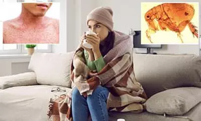 Los Angeles County Faces Record Typhus Outbreak as Cases Surge to All-Time High