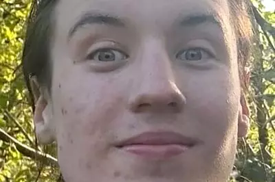 Madness Star Suggs Sings at Vigil for Stabbed Student Finbar Sullivan