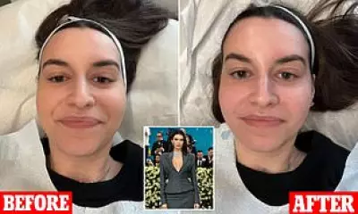 Met Gala Skincare Secrets: HydraFacial and Laser Genesis Treatments Revealed