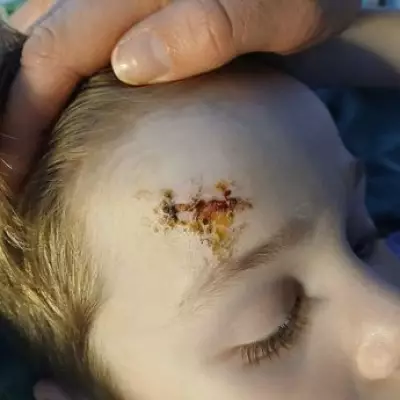 Mother Demands UK Balaclava Ban After Masked Gang Injures Her Son