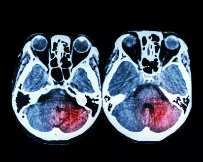 NHS Fails to Deliver 24/7 Stroke Treatment Across England Despite Pledges