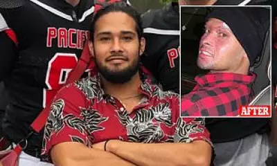 Oregon Man Loses Eight Fingers After Drug-Fueled Fire Incident, Sues Police