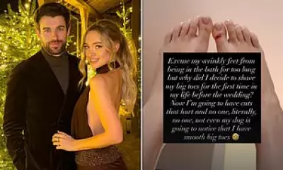 Roxy Horner's Bloodied Toes Mishap Days Before Star-Studded Wedding to Jack Whitehall