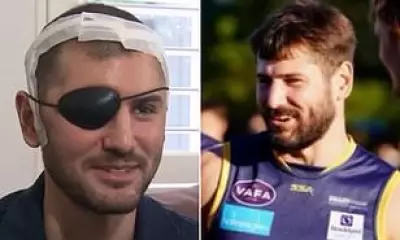Suburban AFL Player Returns as Coach After Losing Eye in Horrific Injury