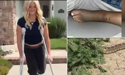 Teen's Terrifying Rattlesnake Bite During California Bike Ride Sparks Warning