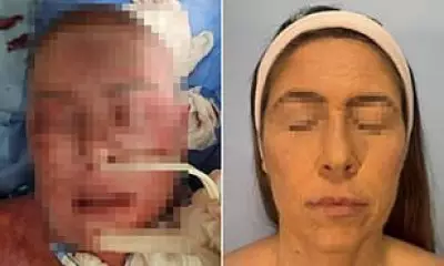 Woman Suffers Severe Burn-Like Marks After Rare Reaction to Common Mood Drug