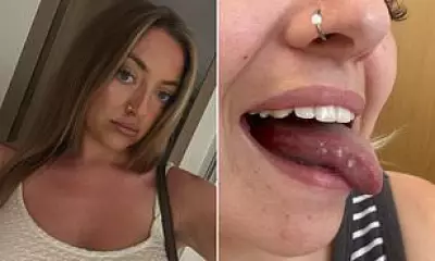 Young Woman Faces Tongue Removal After Ulcers Reveal Cancer Diagnosis